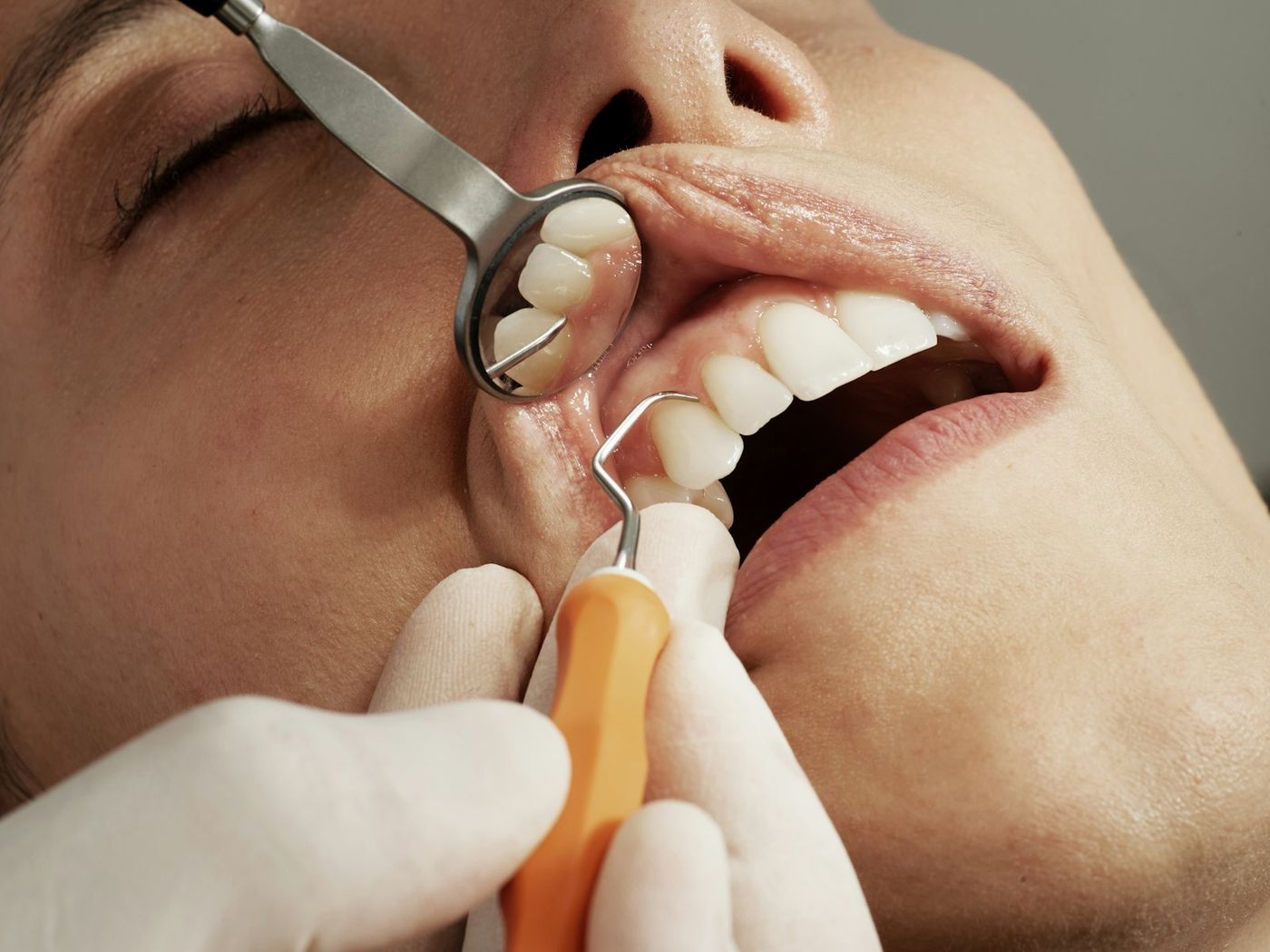 Dental check-up with mirror and probe