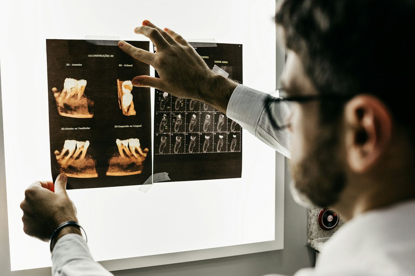Dentist reviewing X-rays on a light box